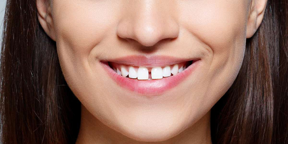 Frenuli labiali e linguali: tutto ciò che c’è da sapere
